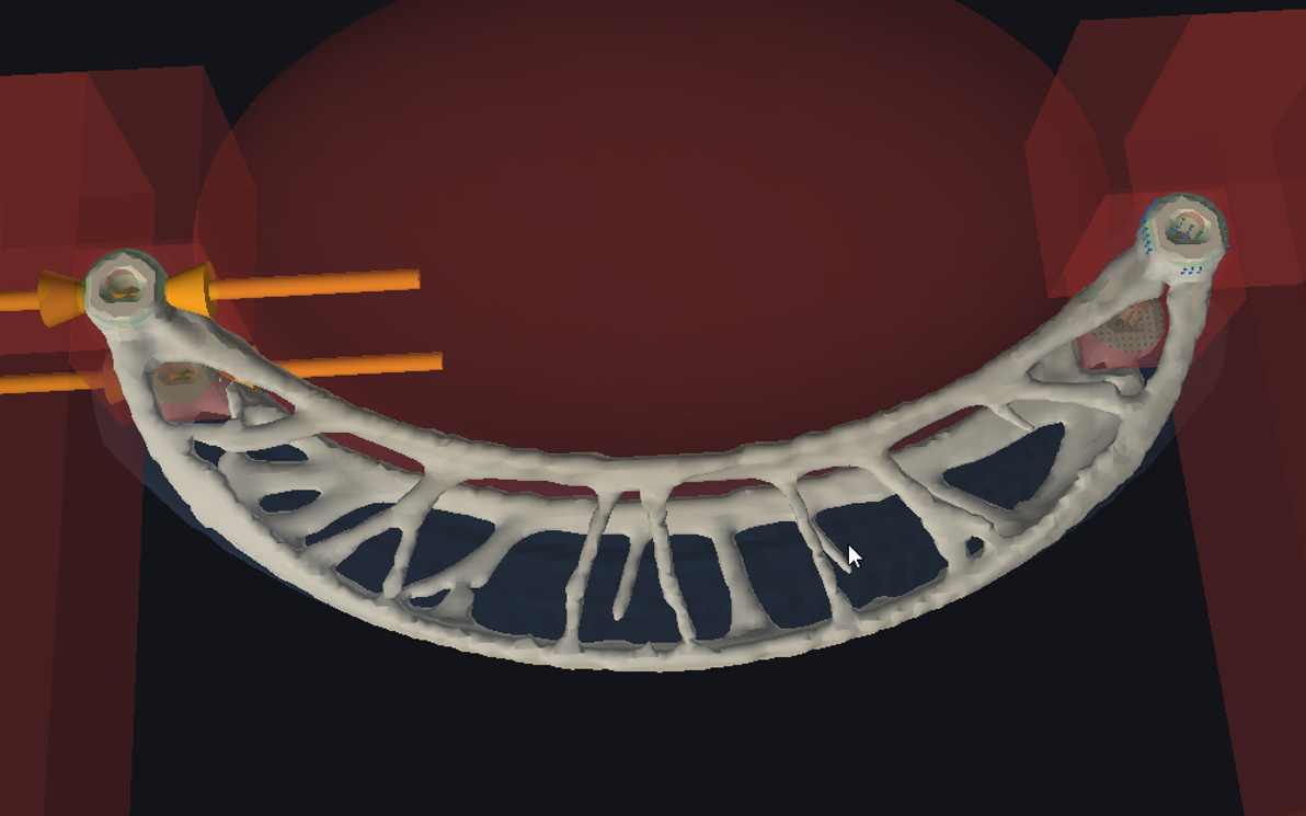 Growforge - a screenshot from the project